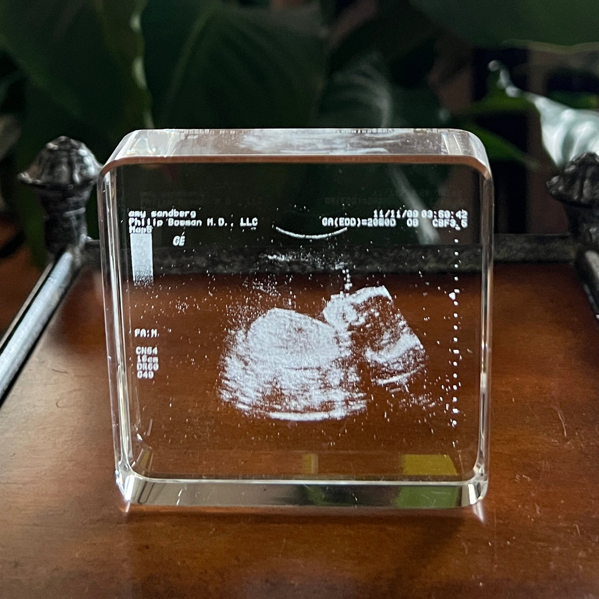 How To Turn Your Sonogram Ultrasound Into The Perfect Keepsake