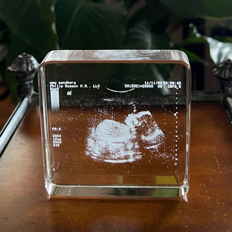 How To Turn Your Sonogram Ultrasound Into The Perfect Keepsake